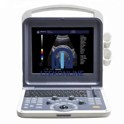 2D 3D 4D Color Doppler Portable Ultrasound Machine