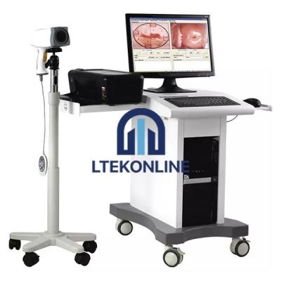 Digital Video Vagina Colposcope for Gynecology