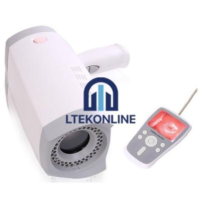 Handheld Video Colposcope