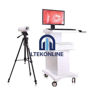 Trolley Video Colposcope
