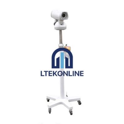 Video Colposcope
